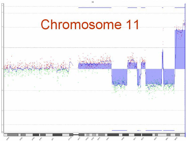 aCGH chromosome 11